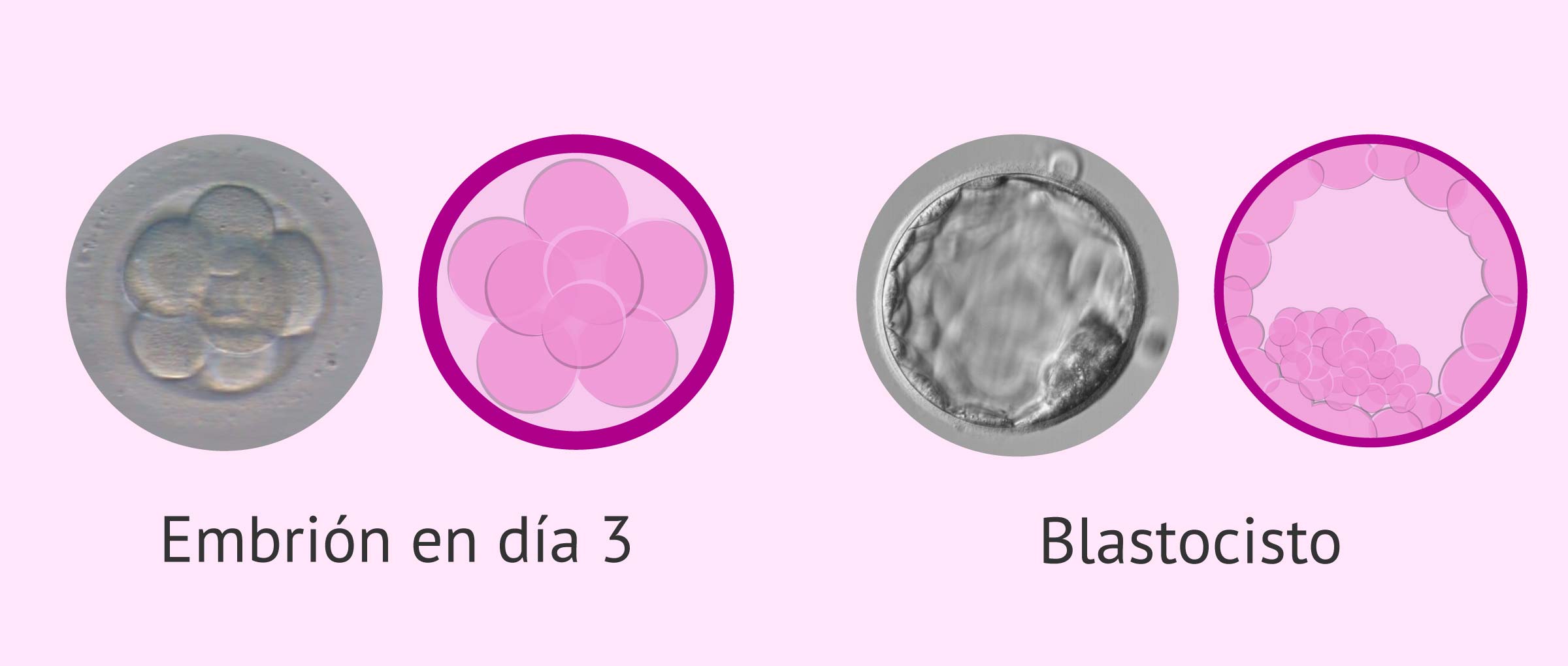 Transferir embriones en día 3 o blastocistos
