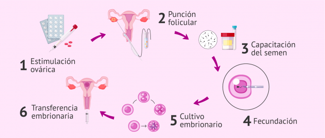Imagen: Proceso de la fecundación in vitro