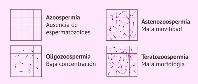Imagen: Indicaciones para hacer FIV-ICSI