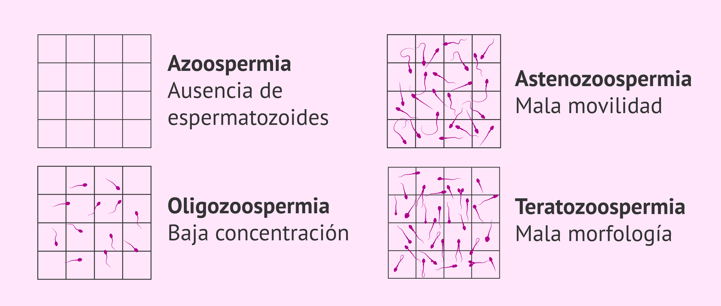 Indicaciones para hacer FIV-ICSI