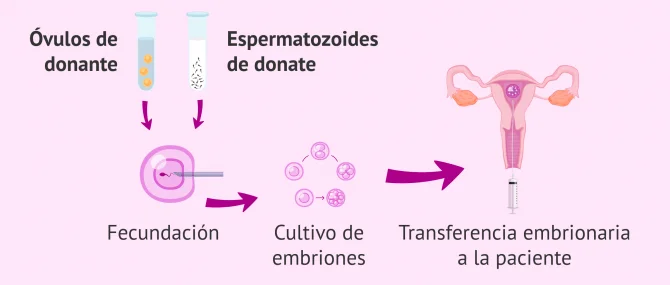 Imagen: FIV con doble donación de gametos