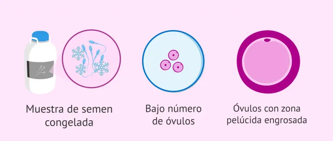 Imagen: Otras situaciones donde se recomienda ICSI