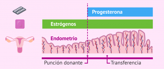 Medicación para preparar el endometrio