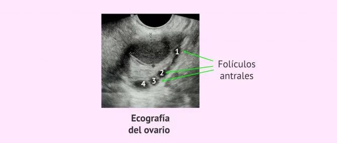 Imagen: Contar folículos