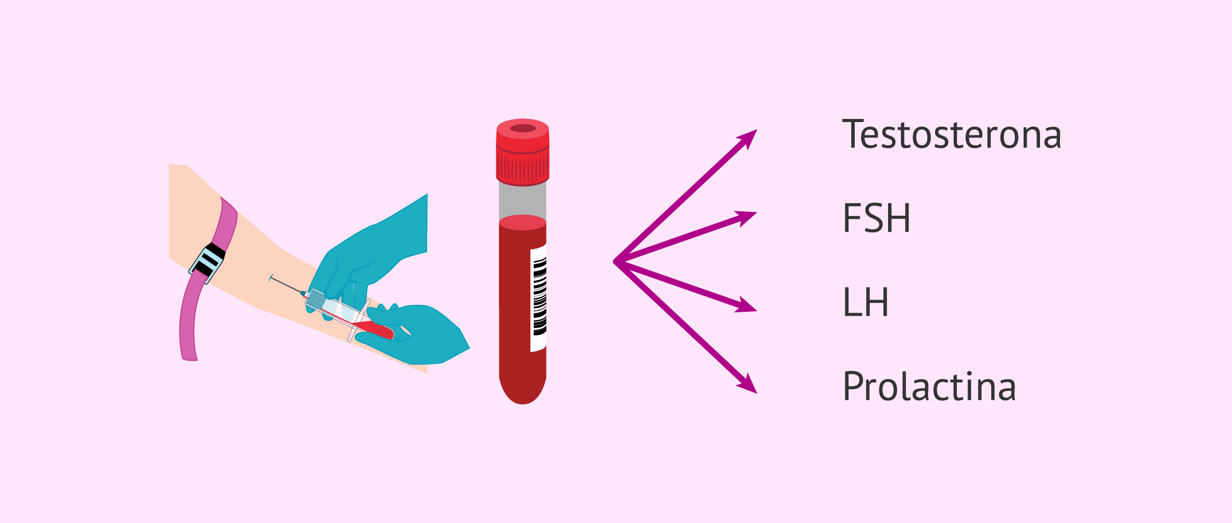 Perfil hormonal para el estudio de la fertilidad masculina