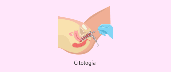 Imagen: Citología para estudiar la fertilidad femenina