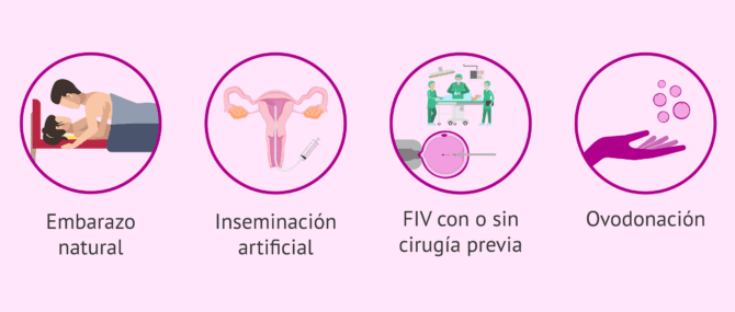 Imagen: ¿Cómo pueden ser madres las mujeres con endometriosis?