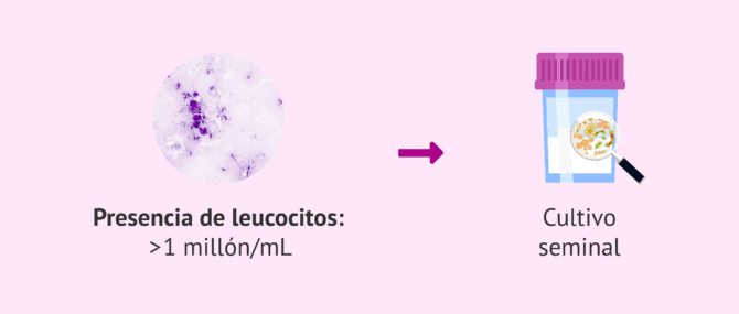 Imagen: Cultivo seminal para detectar agentes infecciosos