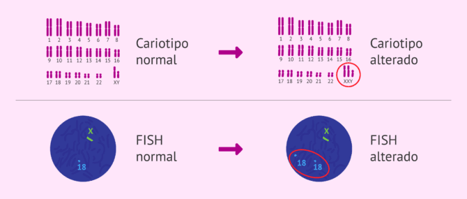 Imagen: Cariotipo y FISH espermático