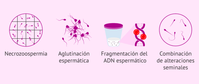 Imagen: Otras causas del factor espermático en el hombre