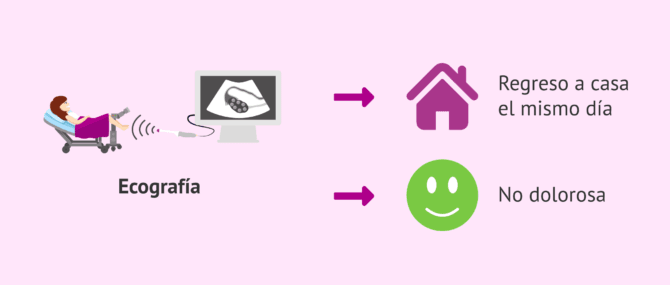 Imagen: Características de la ecografía transvaginal