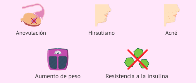 Imagen: Manifestaciones clínicas asociadas al SOP