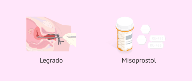 Imagen: Opciones terapéuticas para el aborto espontáneo