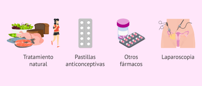 Imagen: Diferentes terapias para el manejo del SOP