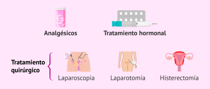 Imagen: Opciones terapéuticas para la endometriosis