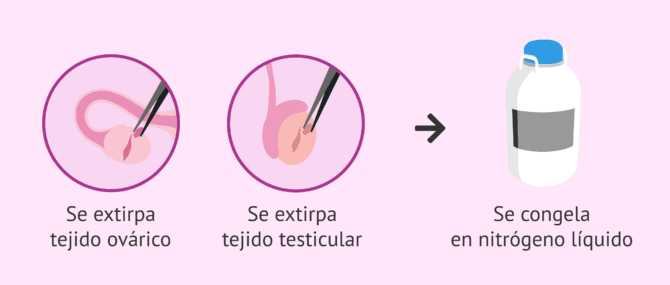 Imagen: criopreservacion-tejido-ovarico-y-testicular