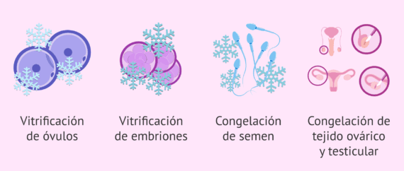 Preservaci n De La Fertilidad Masculina Y Femenina preservaci-n-de-la-fertilidad-masculina-y-femenina
