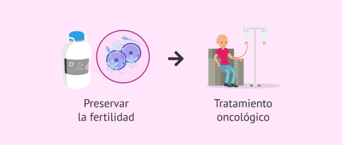 Imagen: Preservar la fertilidad en pacientes oncológicos
