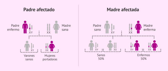 Imagen: Tipos de herencia del síndrome de X Frágil