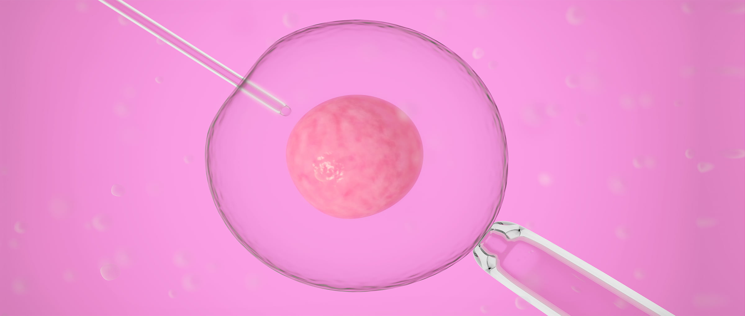 Tratamientos de fertilidad en la República Checa