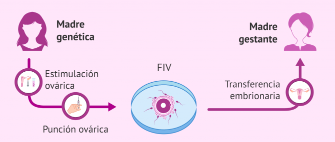Imagen: método ROPA