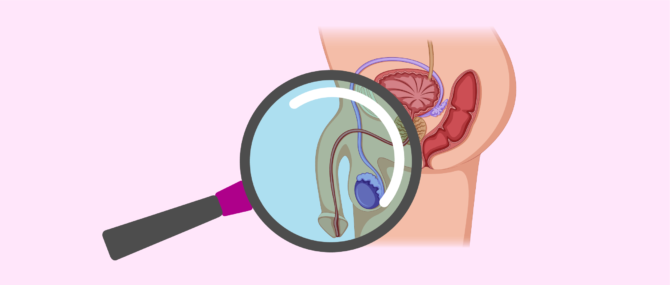 Imagen: Anatomía alterada