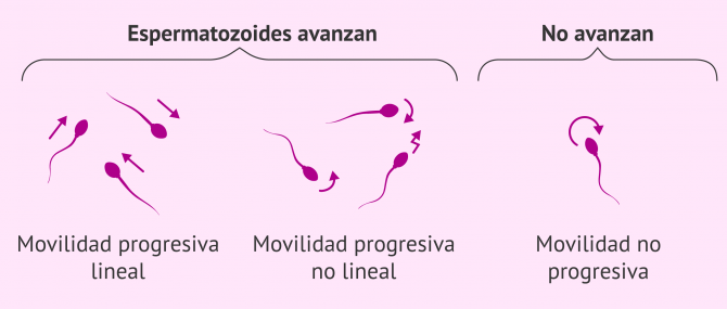 Imagen: Movilidad espermatozoides