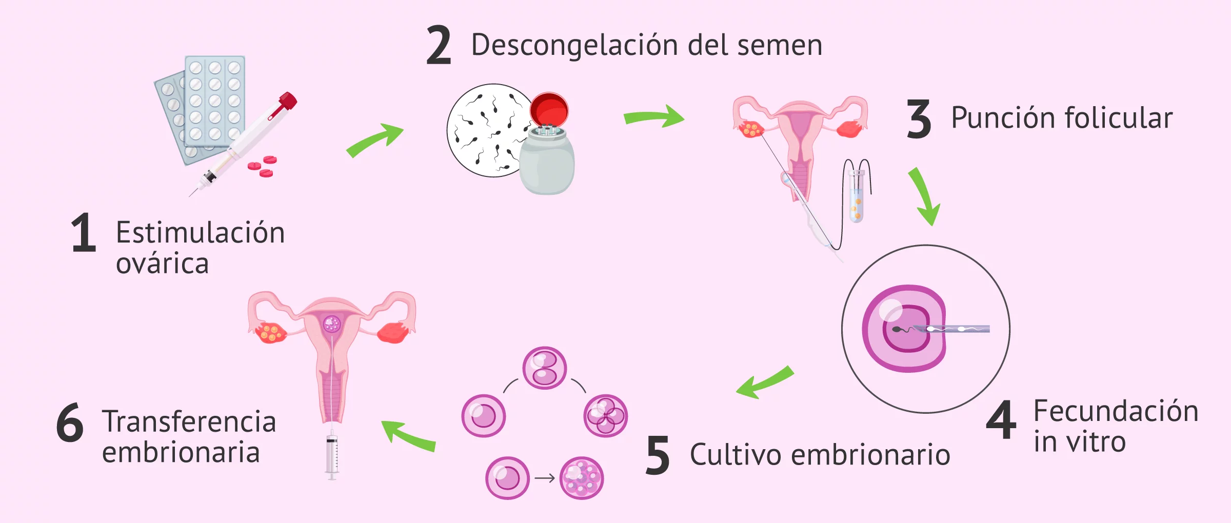 Kit de inseminación artificial casera