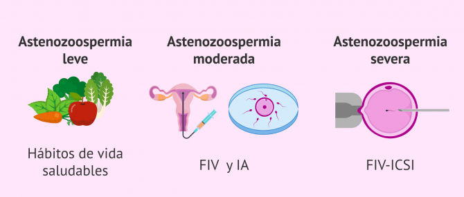 Imagen: Tratamientos para lograr el embarazo con astenozoospermia