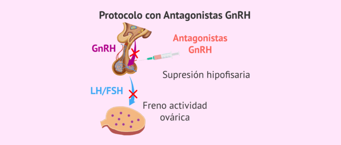 Imagen: Mecanismo de acción de los antagonistas de la GnRH