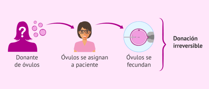 Imagen: La donación de óvulos no es reversible